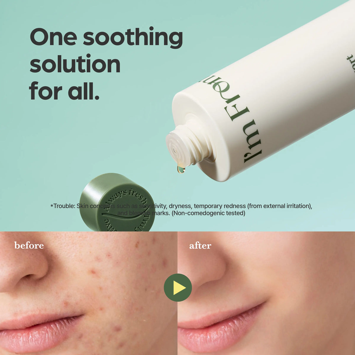 Revitalize Your Skin with I’M from Mugwort Essence - Soothing Hydration for Sensitive Skin, 5.41 Fl.Oz of Pure Korean Skincare