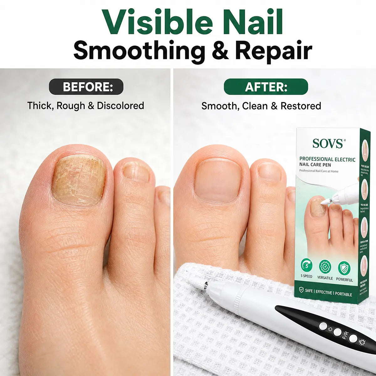 SOVS Electric Nail Drill Machine - Your Ultimate At-Home Salon Tool for Perfect Manicures and Pedicures, Lightweight and Portable for Effortless Grooming